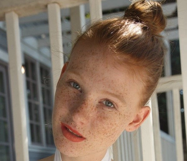 Abby Vissers